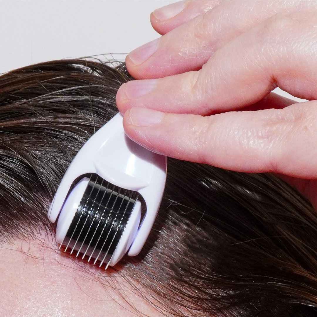 An individual uses the Growth Bomb US Derma Roller, which is white and features countless tiny needles, gripping it securely to apply along the hairline for scalp care.