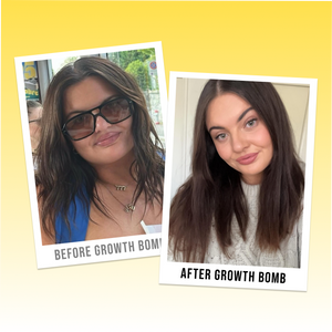 Side-by-side photos of a woman: on the left, before using 250 ML Supercharge Shampoo; on the right, after use, her hair appears straighter, longer, and healthier.