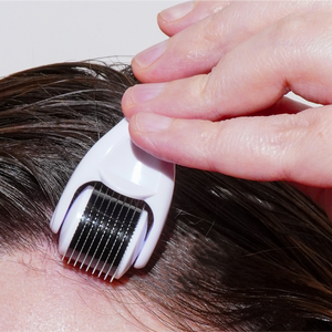 An individual uses the Growth Bomb US Derma Roller, which is white and features countless tiny needles, gripping it securely to apply along the hairline for scalp care.