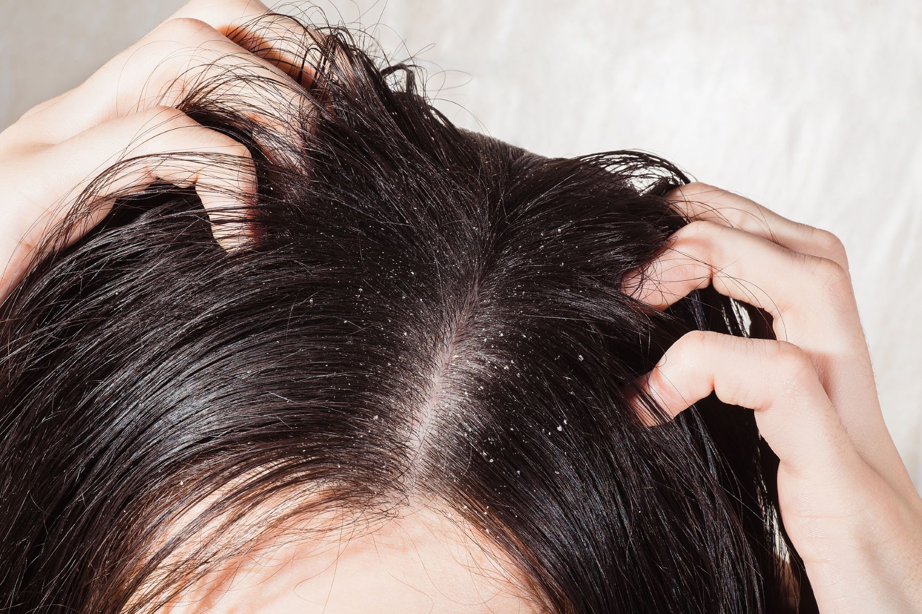 what causes thinning hair?